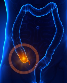 cirugia apendicitis cancun